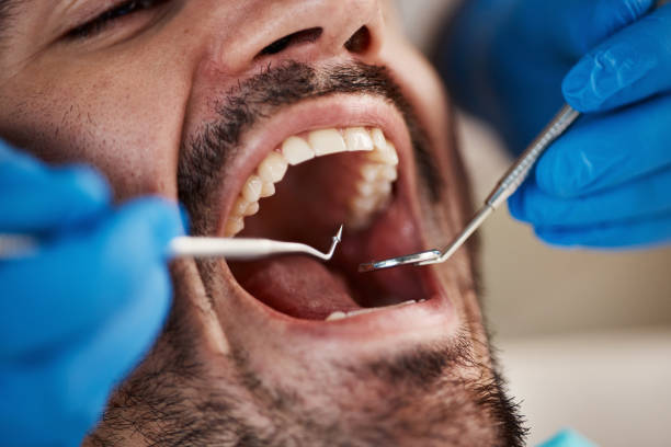 Best Emergency Dentist for Knocked-Out Tooth in Lowell, NC