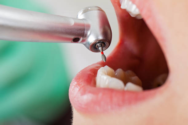 Best Emergency Cosmetic Dentistry in Lowell, NC